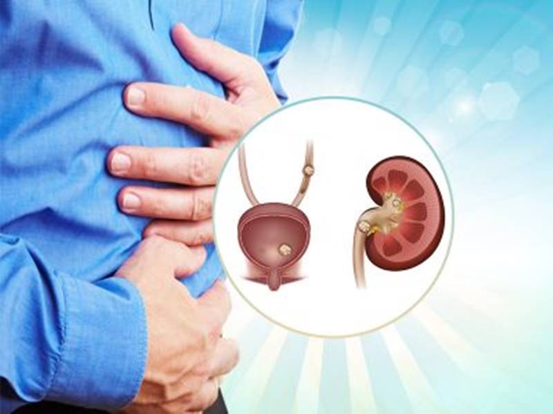 Effective Home Remedies To Break Down Kidney Stones lifealth